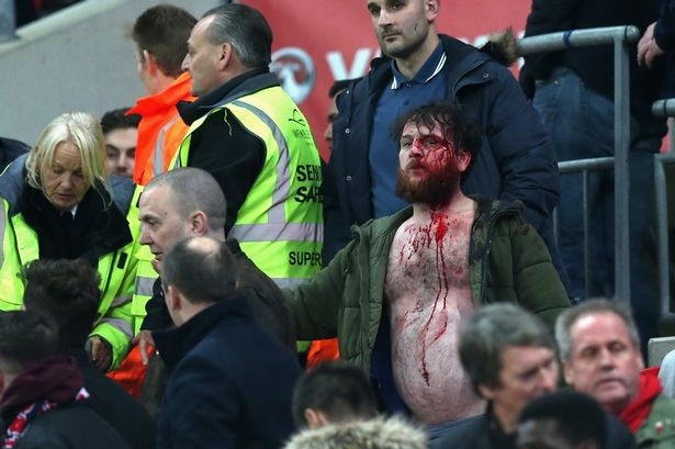 au da tran Anh,  Scotland anh 4