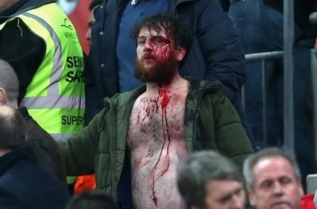 Co dong vien Anh do mau sau tran au da tai Wembley hinh anh