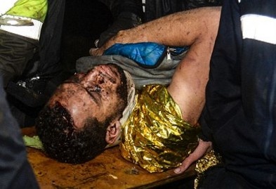 Mot nan nhan tham kich Chapecoense co the choi bong tro lai hinh anh