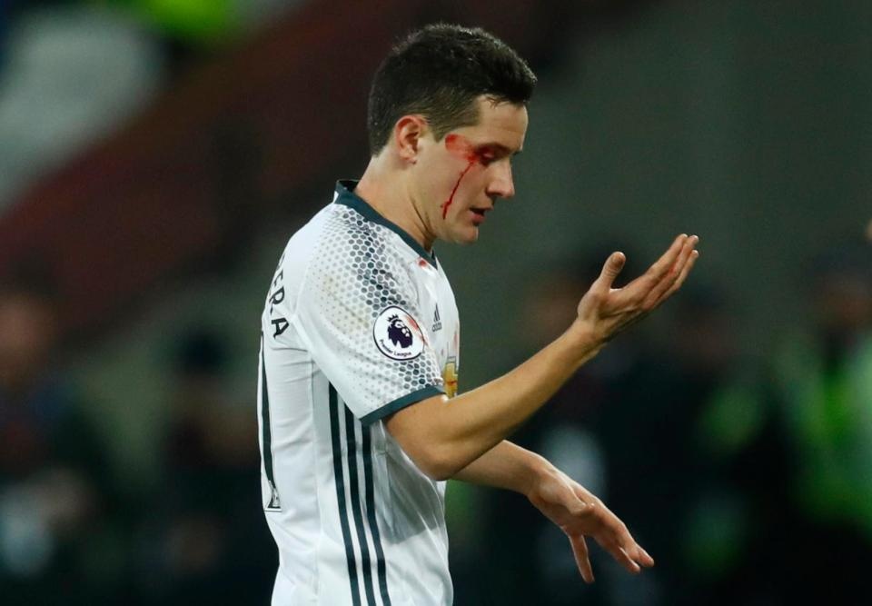 Doi bong nao dinh nhieu chan thuong nhat NHA anh 3