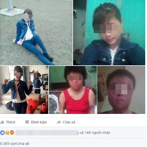 cô gái bị chồng thiêu sống đến biến dạng ảnh 1 co gai bi chong thieu song den bien dang anh 1