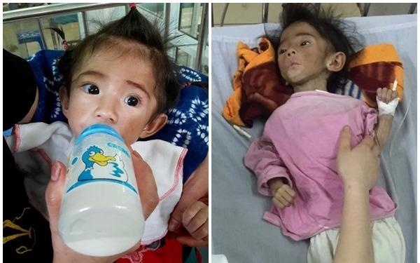 Be gai 14 thang tuoi nang 3,5 kg bat dau 'co da co thit' hinh anh