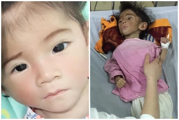 Be gai 14 thang bi suy dinh duong tang len 6kg anh 1