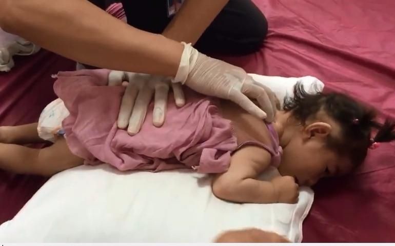 Be Yen Nhi luyen tap phuc hoi chuc nang hinh anh