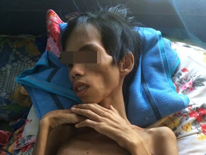 9X Kon Tum bi dam vi ghen tuong chi con da boc xuong hinh anh