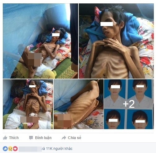 9X Kon Tum chỉ còn da bọc xương ảnh 1 9X Kon Tum chi con da boc xuong anh 1