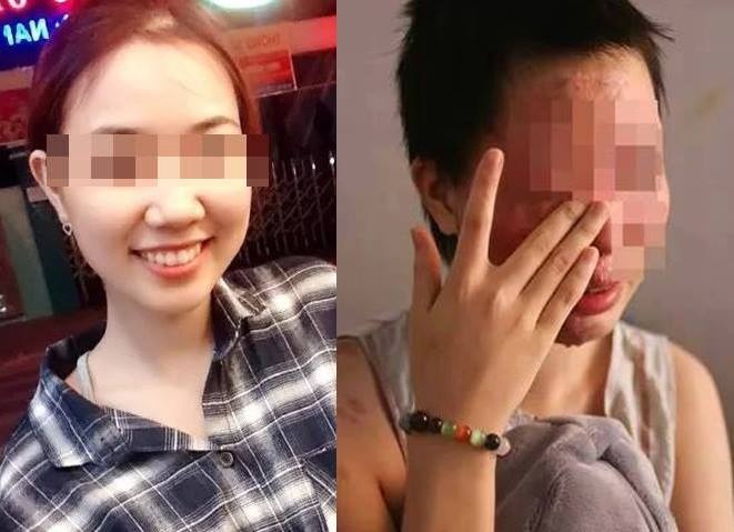 9X Kon Tum bi dam chet anh 2