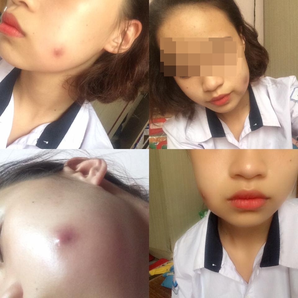 9X nguy co thung ma vi ma lum anh 1