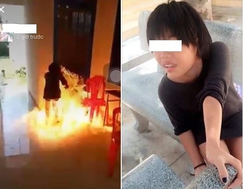 hinh anh gay chu y tuan anh 1