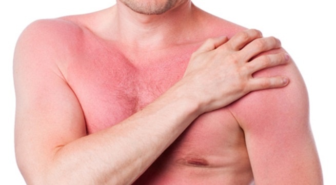 Tai sao con nguoi bi di ung? hinh anh