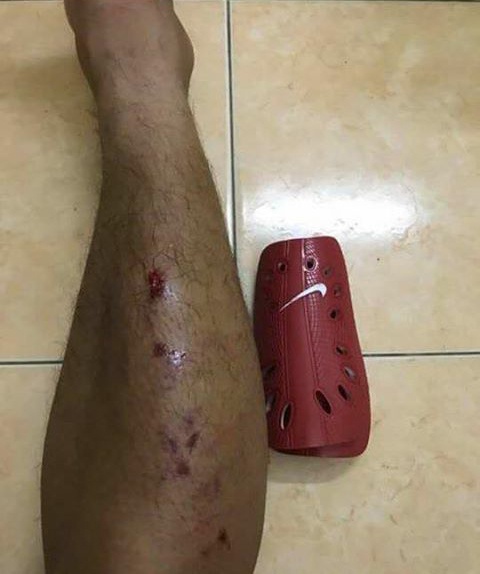 ngoc duc triet ha doi thu anh 2