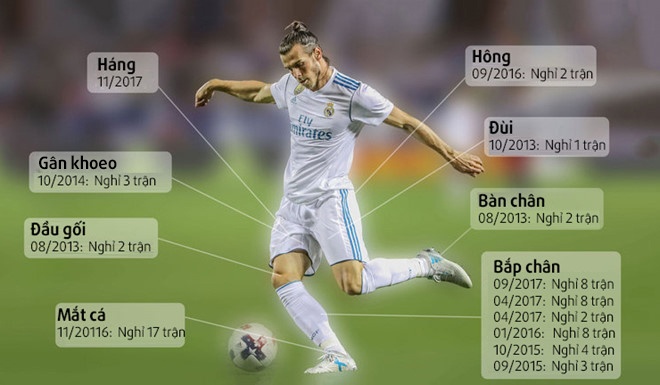 Bale chan thuong anh 3