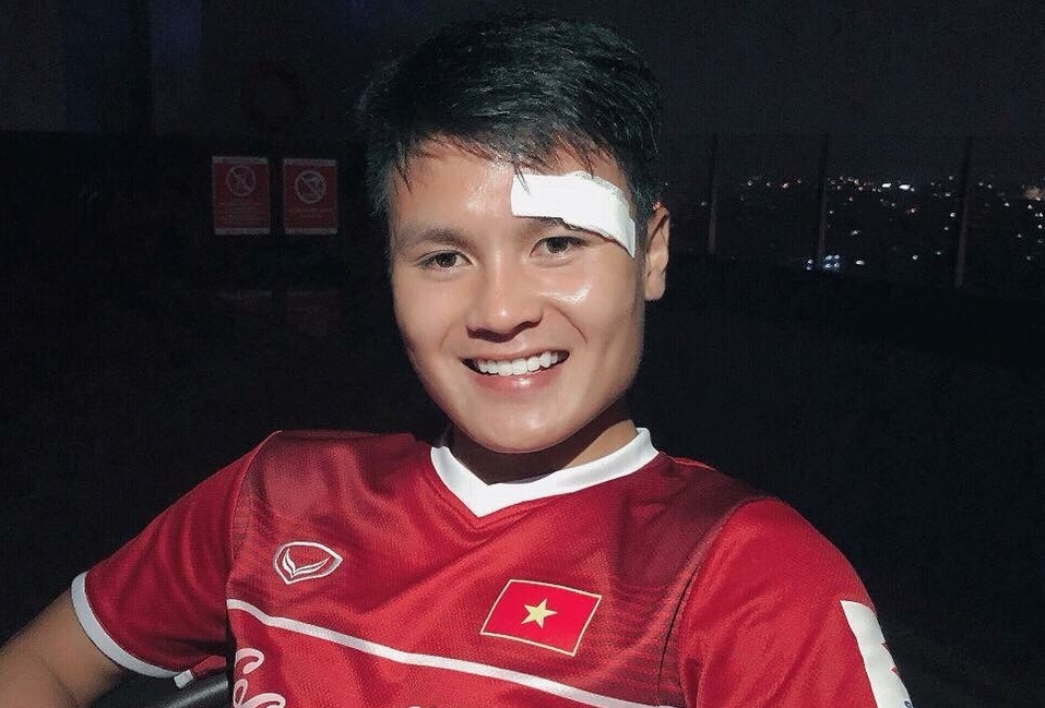 Quang Hai khoe anh dep trai du rach mi mat truoc Olympic Syria hinh anh