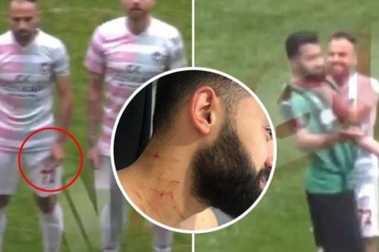 cam thi dau tron doi anh 1