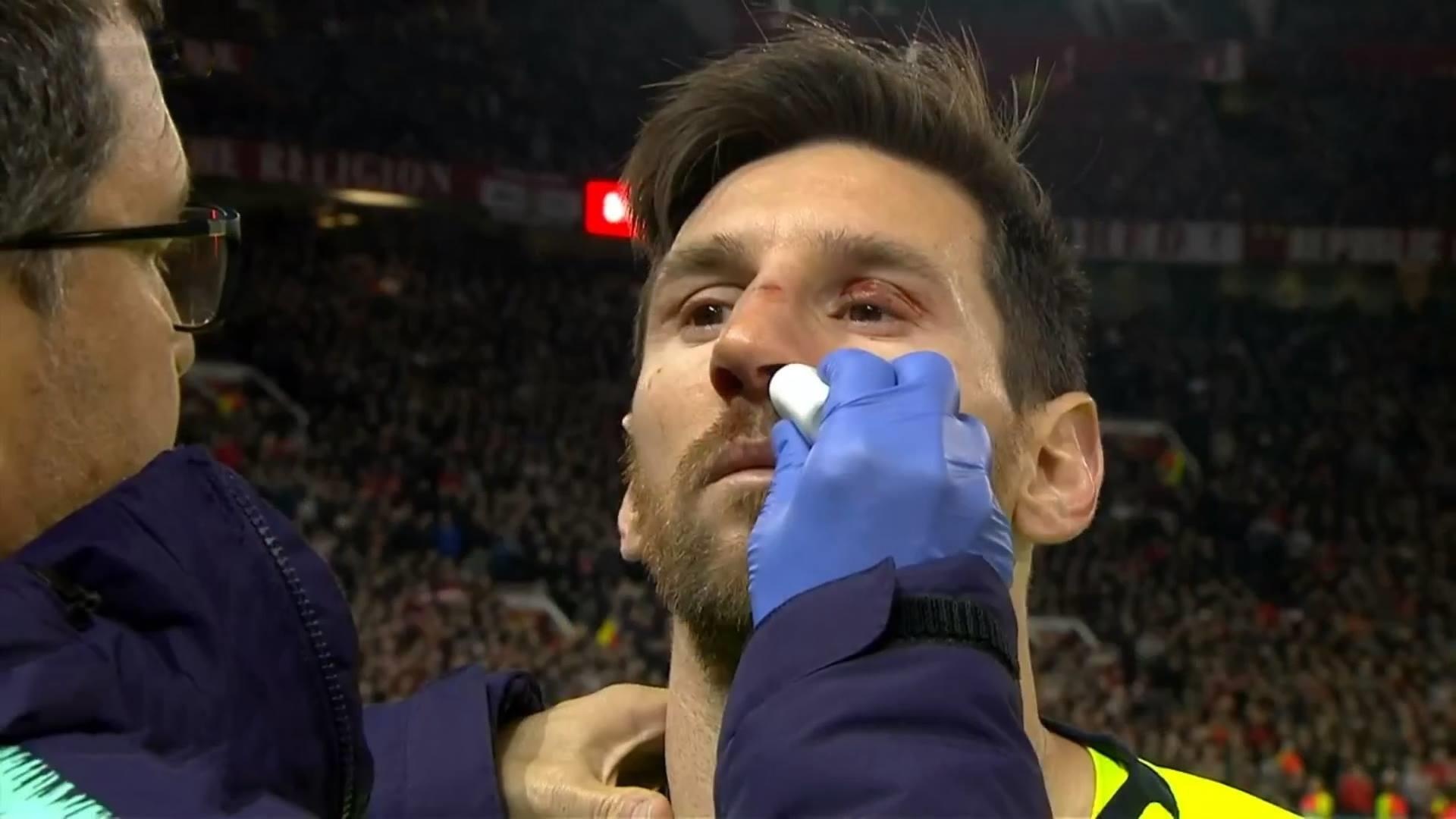 'Messi va cham voi Smalling khong khac gi bi tau can qua' hinh anh