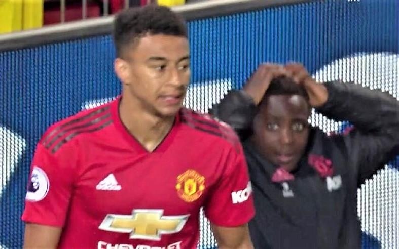 Cau be nhat bong soc nang sau pha bo lo kho tin cua Lingard hinh anh