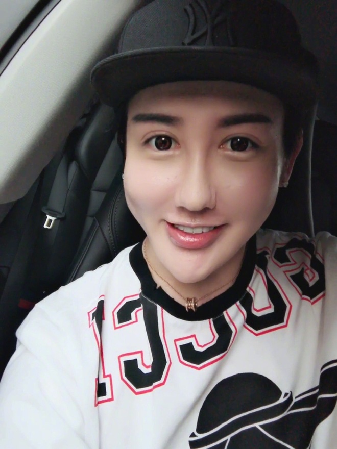 phau thuat tham my de giong bup be anh 9