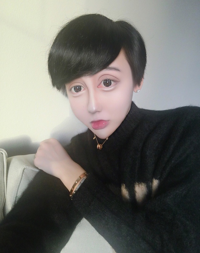 phau thuat tham my de giong bup be anh 10