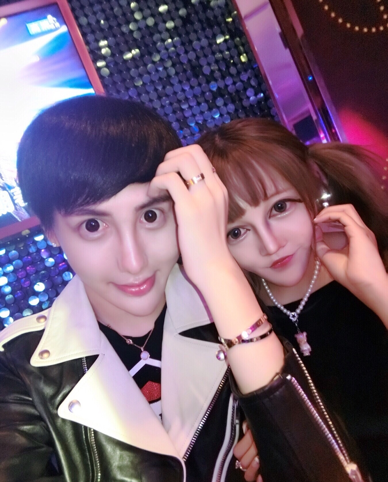 phau thuat tham my de giong bup be anh 8