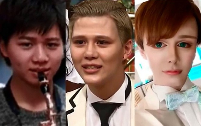 phau thuat tham my giong bup be anh 1