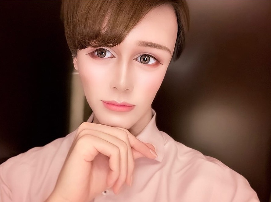 phau thuat tham my giong bup be anh 5