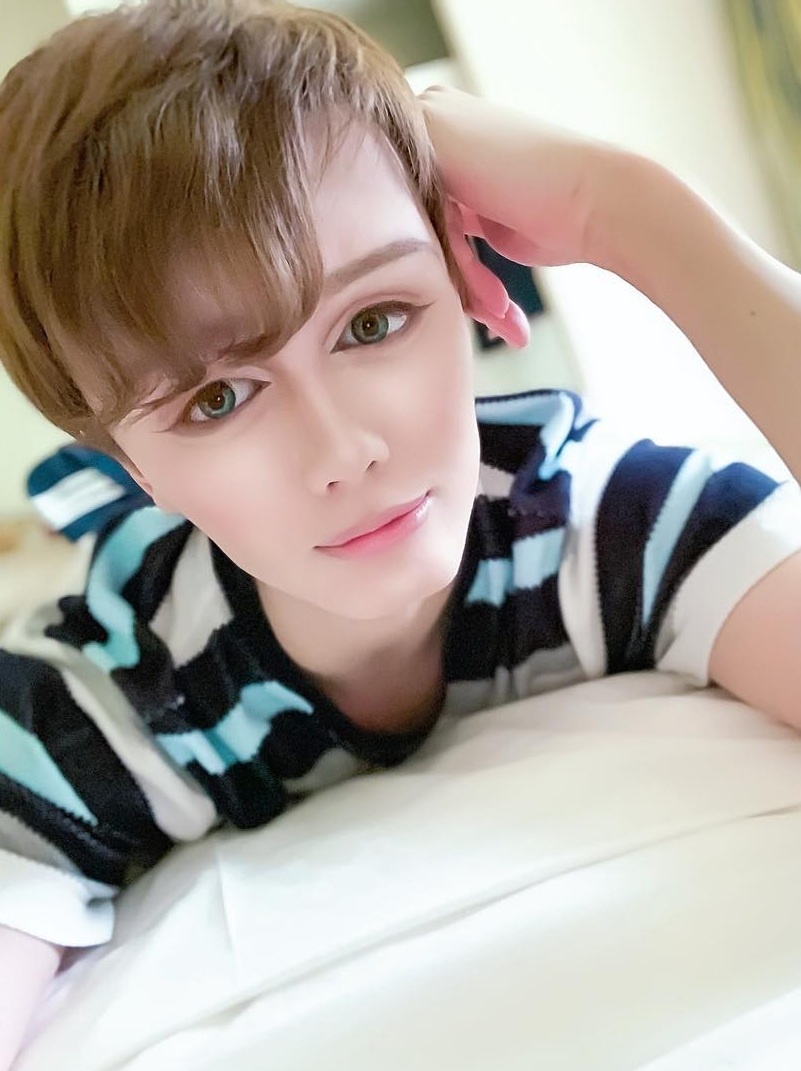 phau thuat tham my de giong bup be anh 2