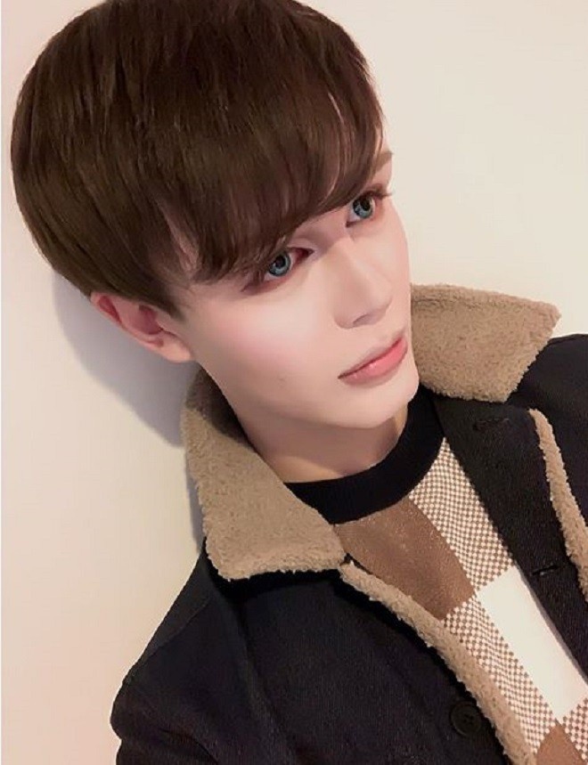 phau thuat tham my giong bup be anh 4