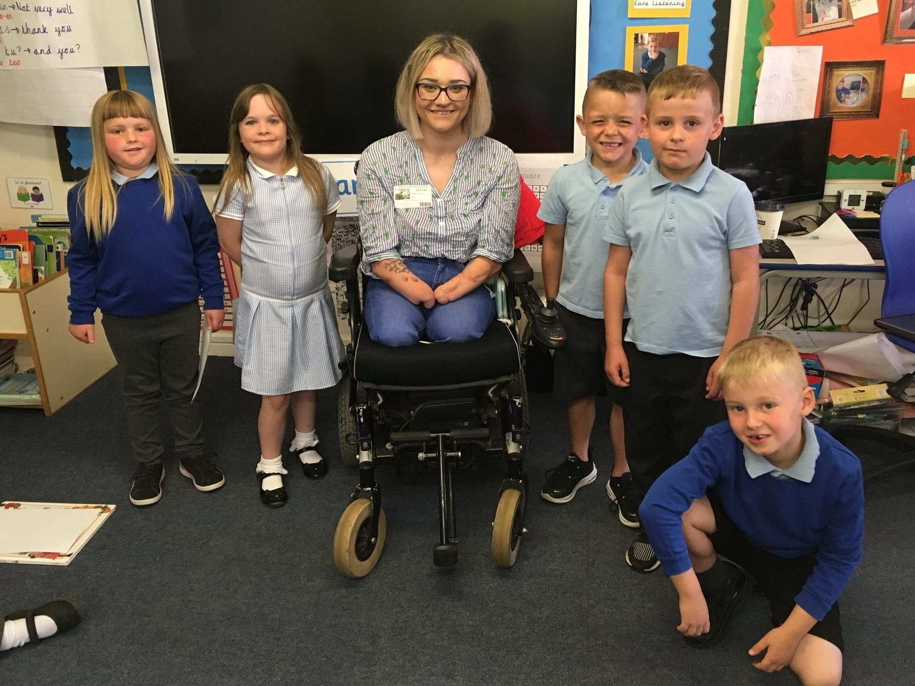 beauty blogger cụt tay chân ảnh 2 beauty blogger cut tay chan anh 2