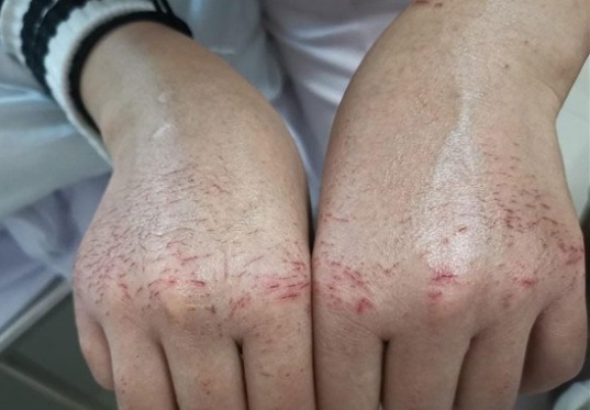 y tá bác sĩ vũ hán ảnh 2 y ta bac si vu han anh 2