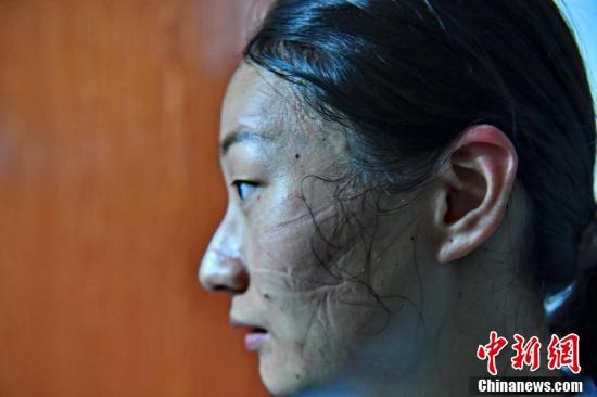 bác sĩ ở khu cách ly corona ảnh 3 bac si o khu cach ly corona anh 3