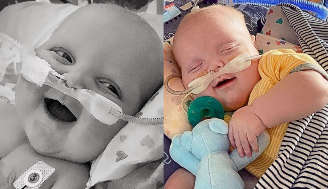 Em be lan dau tien cuoi voi bo me sau 2 lan phau thuat tim hinh anh