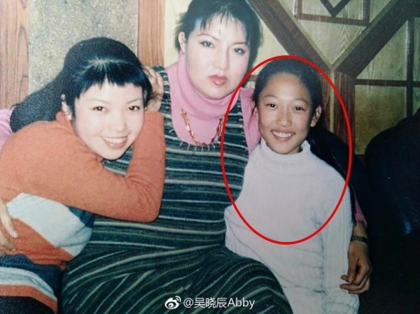 Hot girl phẫu thuật thẩm mỹ ảnh 6 Hot girl phau thuat tham my anh 6