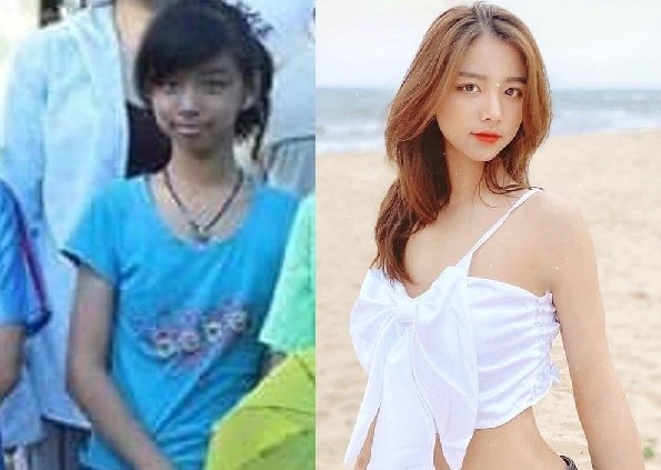 Day thi thanh cong, 4 nu sinh bi nghi ngo phau thuat tham my hinh anh