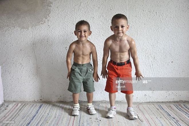 cau be co bap anh 10