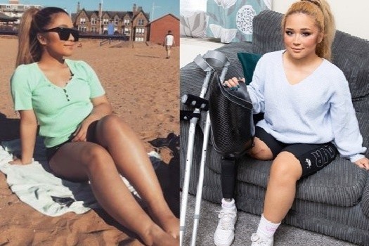 Y ta Anh phai cua cut chan sau nhieu thang ban chong dich hinh anh