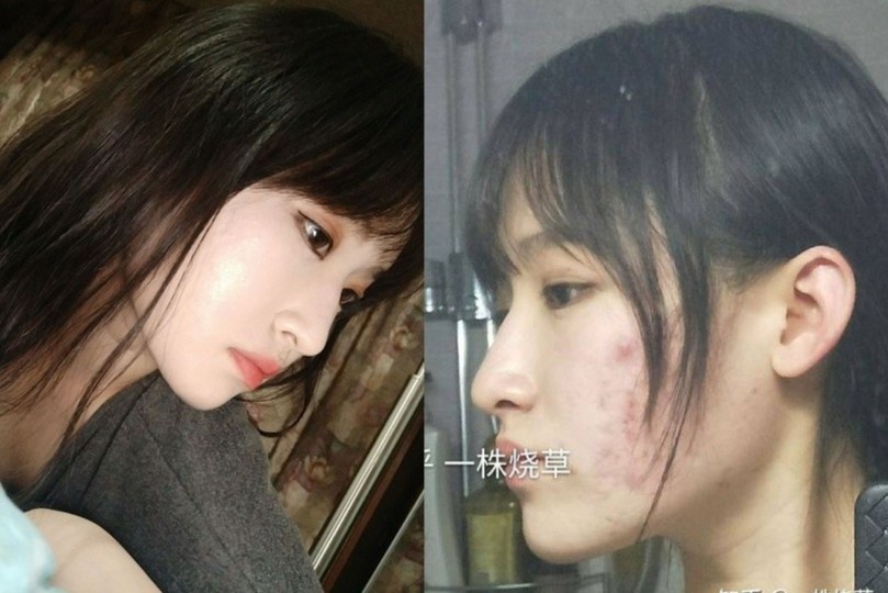 Co gai TQ khien fan tranh cai khi cong khai anh mat moc hinh anh