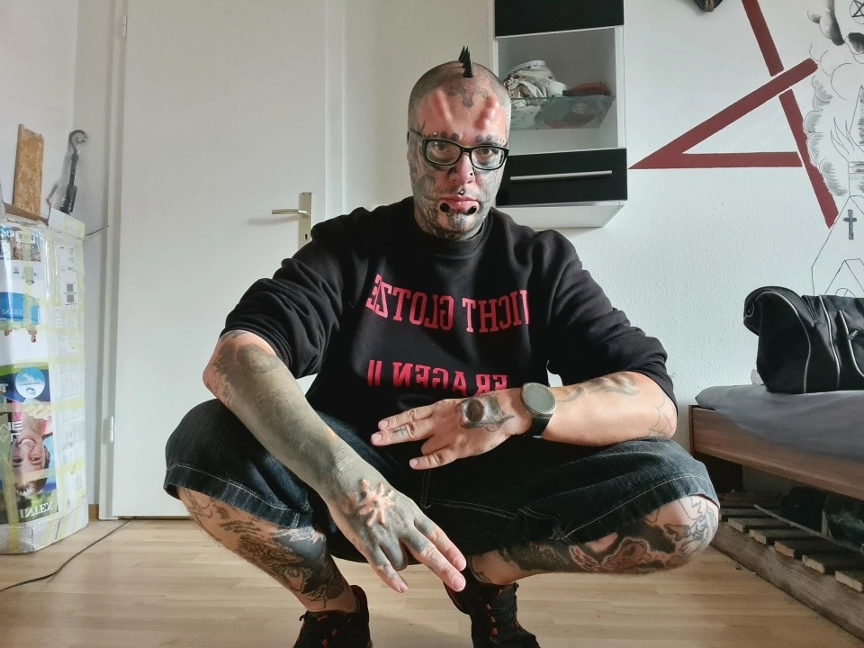 phau thuat tham my qua da anh 1