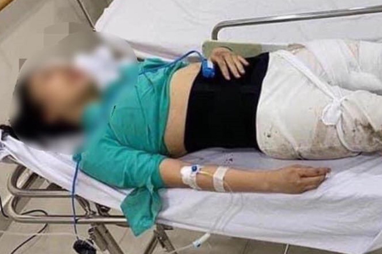Tiep vien hang khong bi xe Mercedes tong: 'Toi muon doi cong bang' hinh anh