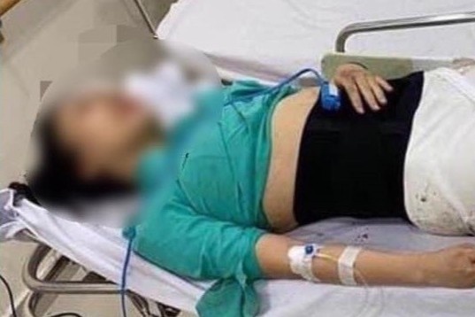 Tiep vien hang khong bi xe Mercedes tong: 'Cam on dan mang' hinh anh