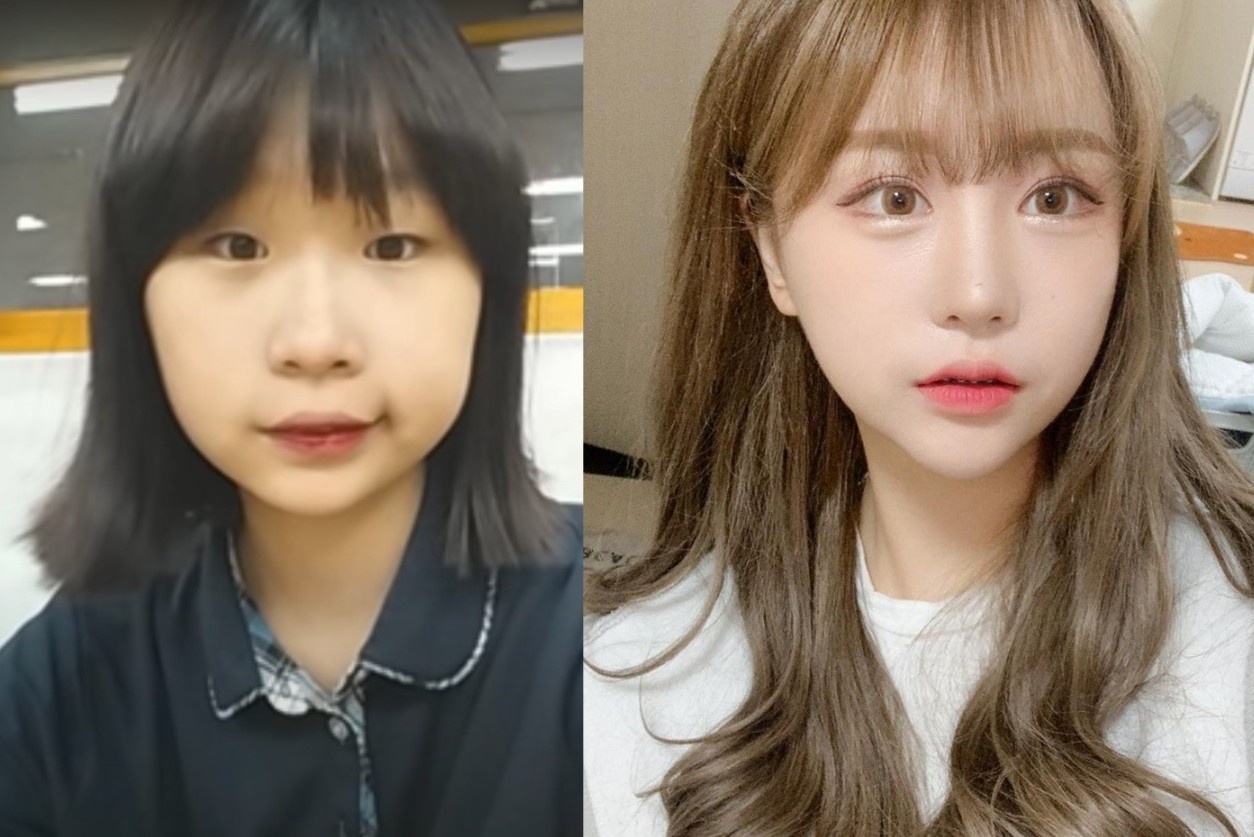 Hot girl Han Quoc phau thuat tham my toan co the hinh anh