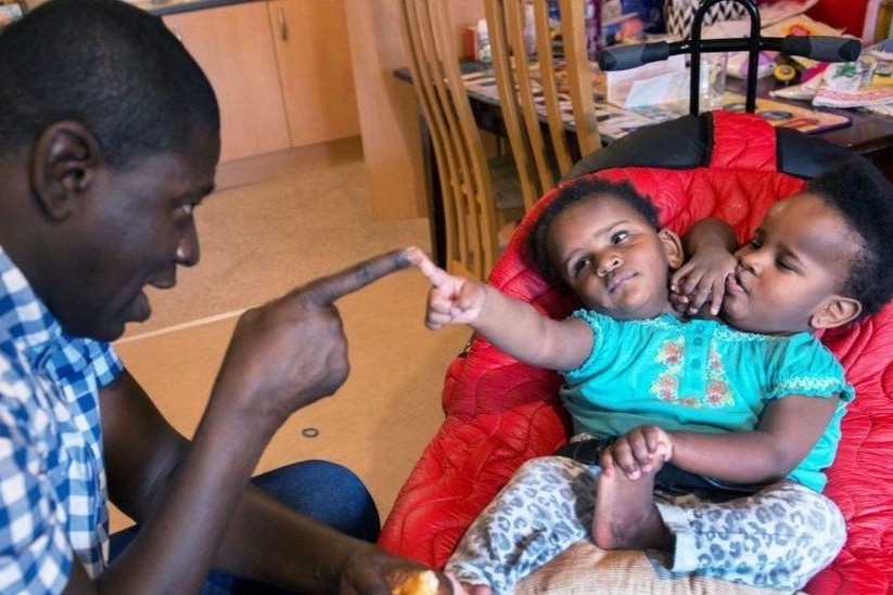 Con duong den truong cua cap song sinh dinh lien hinh anh