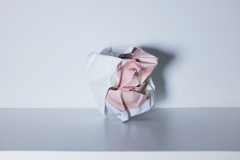 phau thuat tham my chui anh 4