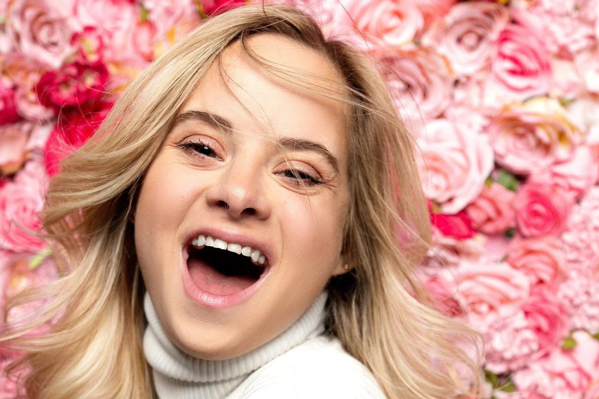 Co gai mac hoi chung Down tro thanh thien than noi y hinh anh