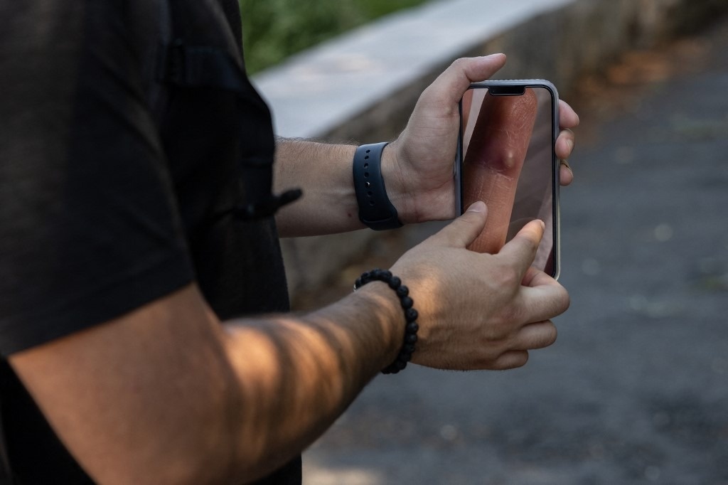 dich dau mua khi anh 3