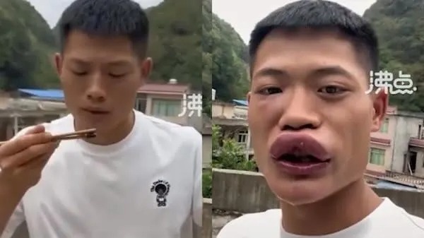 an ong bap cay anh 1