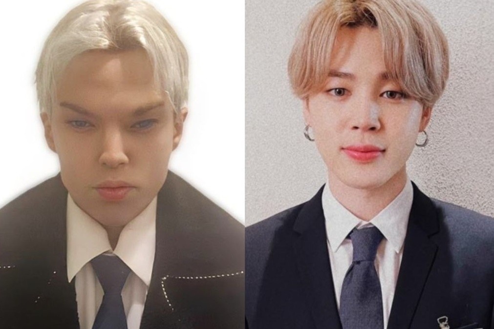 Cu lua tu vu dien vien qua doi vi phau thuat 12 lan de giong Jimin hinh anh