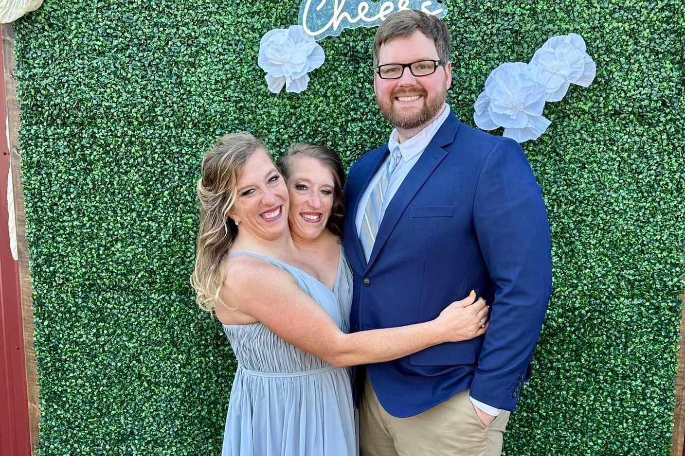 Cuoc song hon nhan cua cap song sinh dinh lien hinh anh