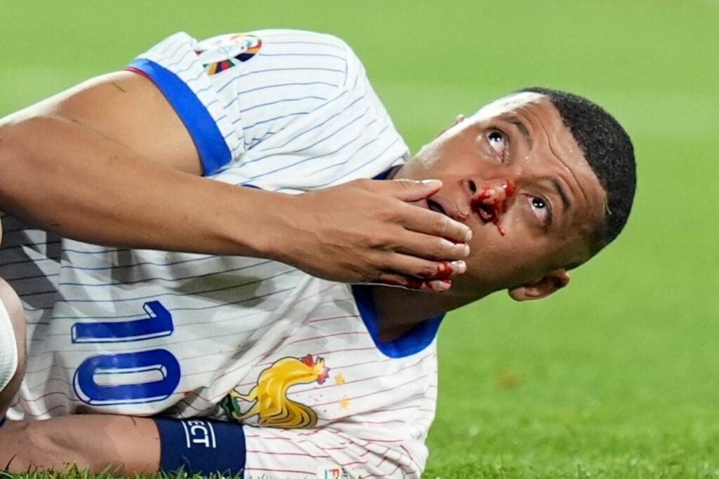 Cuu vo si tung 15 lan gay mui canh bao Mbappe hinh anh