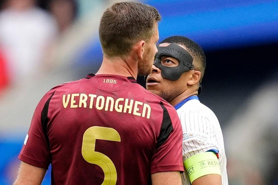 Mbappe che gieu cau thu Bi dot luoi nha hinh anh