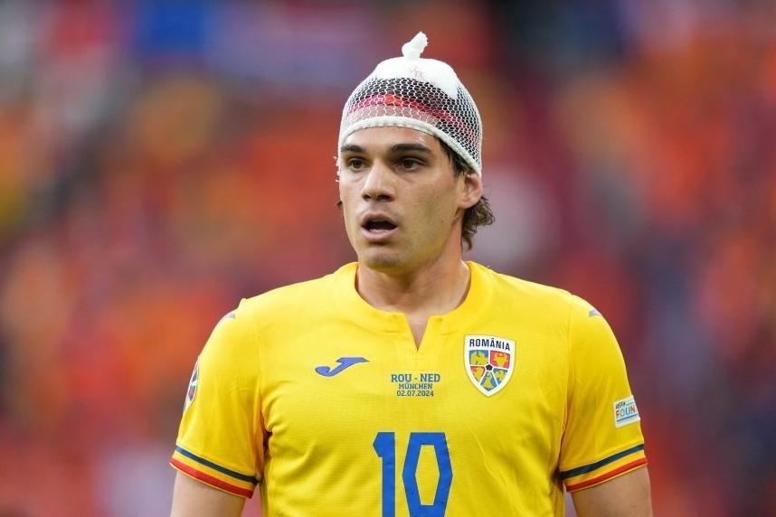 'Toc cu hanh' cua cau thu EURO gay chu y hinh anh